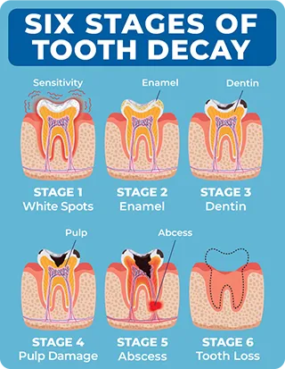 Oral Health Image