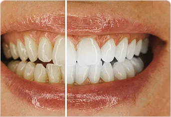 4. Naturally Whitens Without Damage*