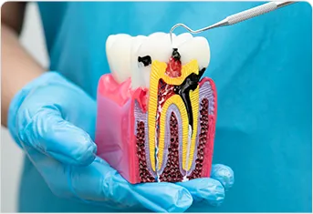 2. Fights Cavities From Day One*